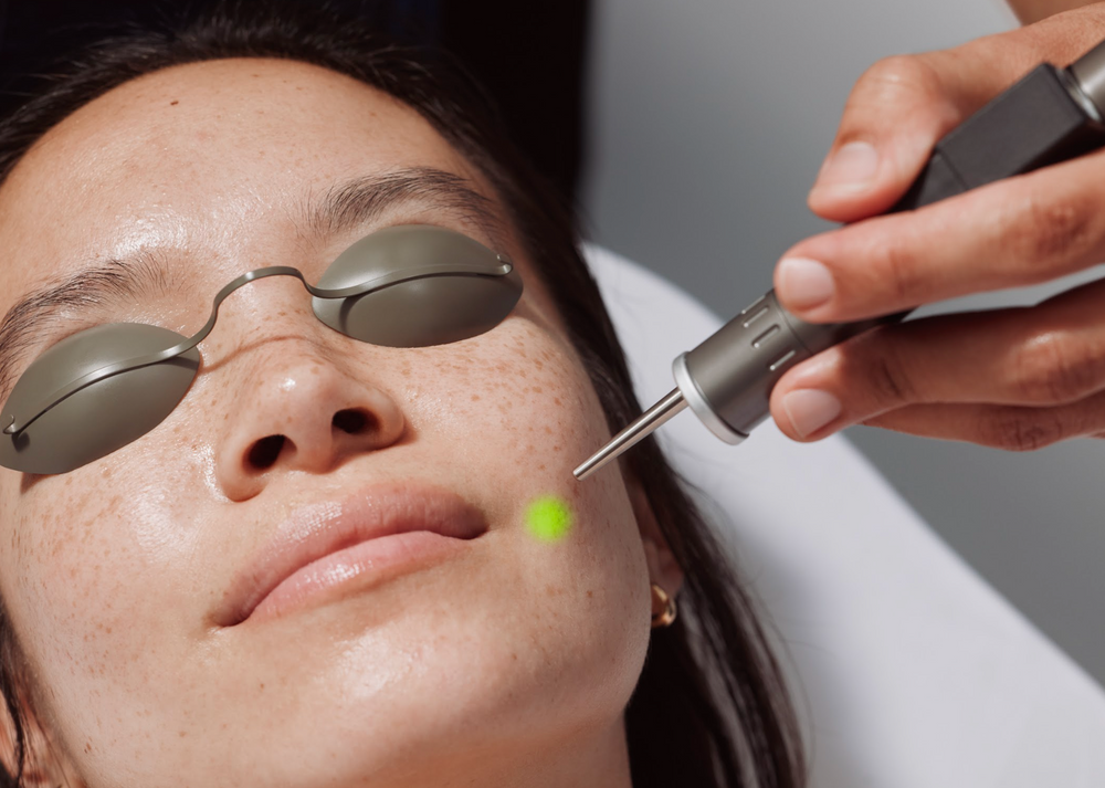 the Elite Laser Facial at Heyday