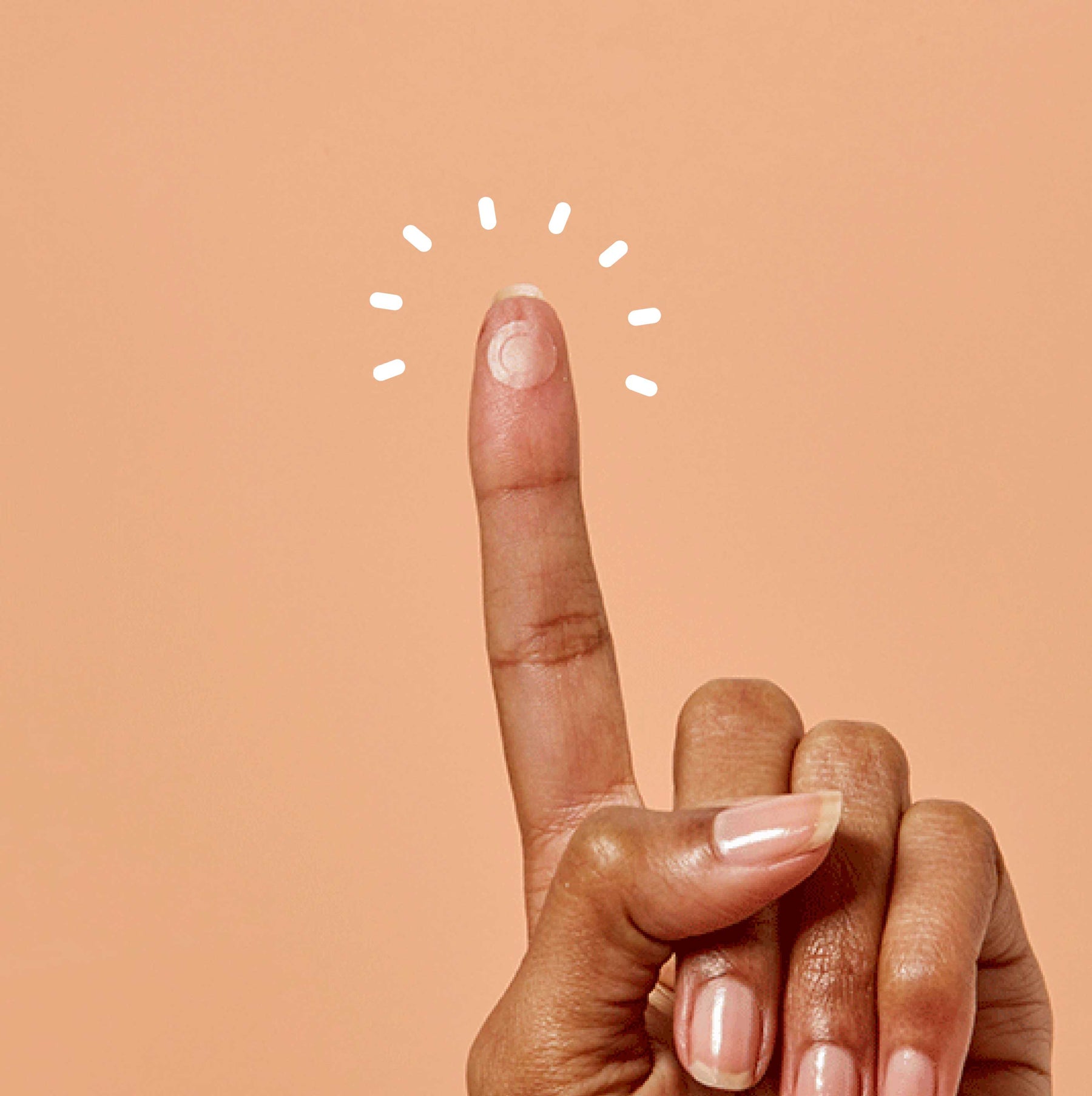 your top acne questions, answered