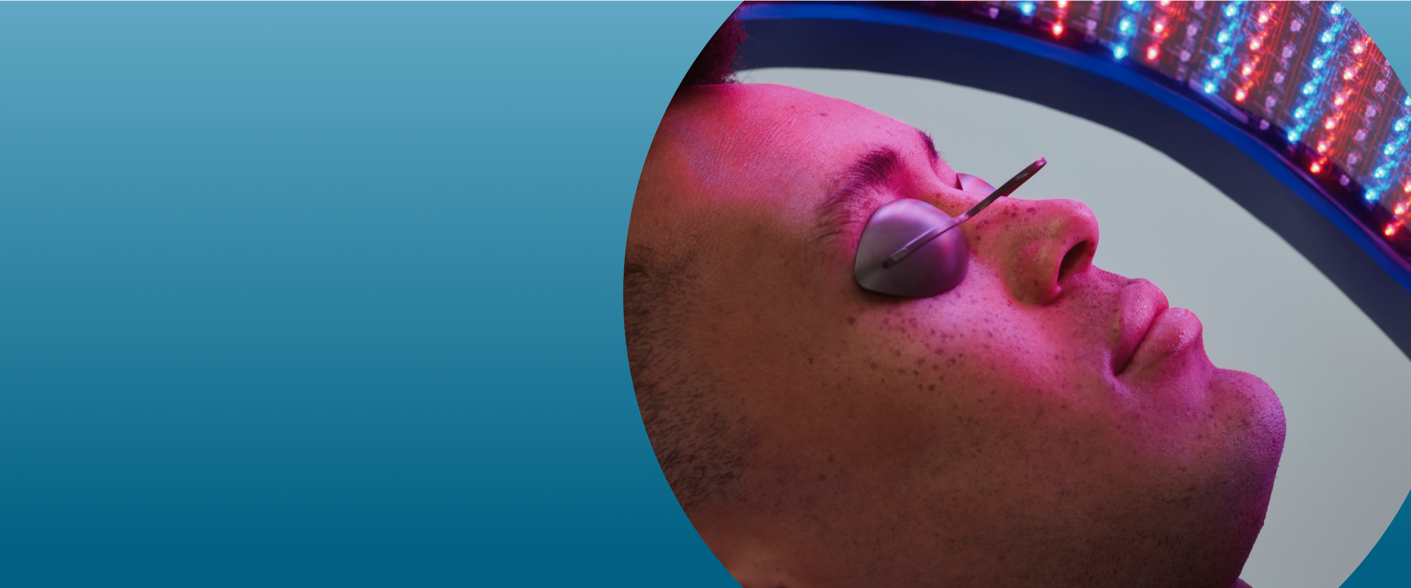 Heyday LED Light Therapy Enhancement