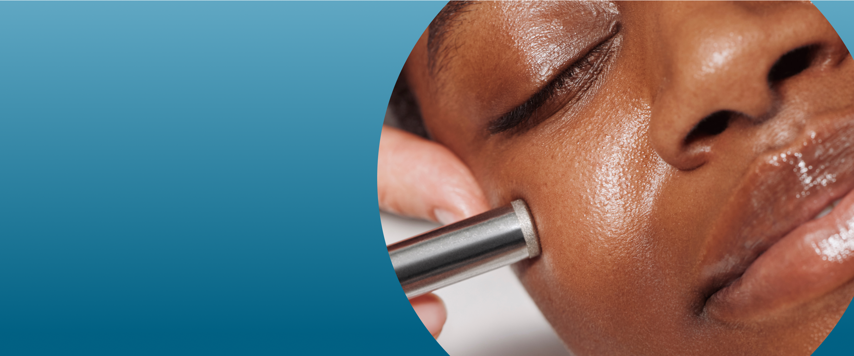 Heyday Diamond Tip Microdermabrasion Enhancement