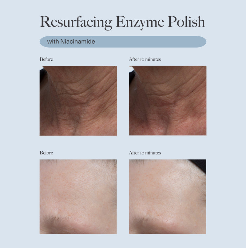 Resurfacing Enzyme Polish