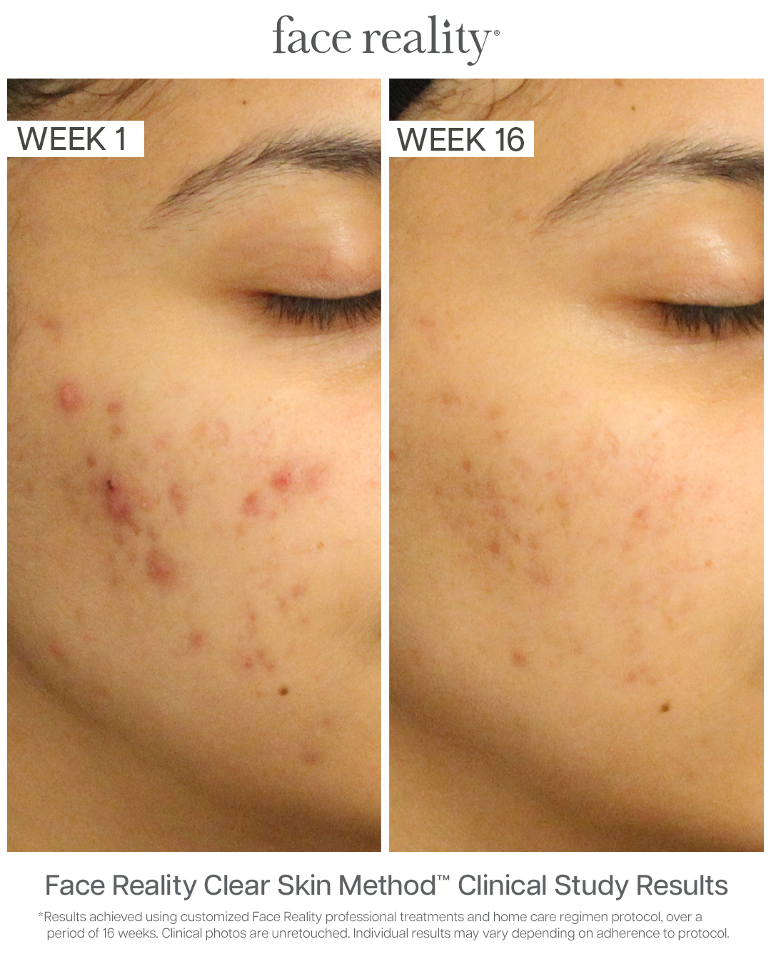 ClearDerma moisturizer