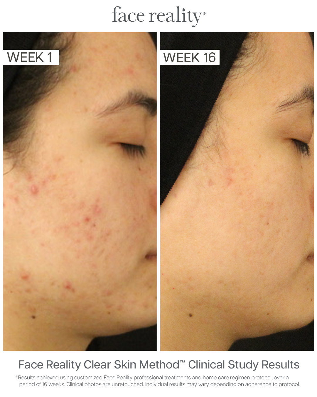 Moisture Balance Toner