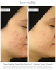 Sulfur Spot Treatment