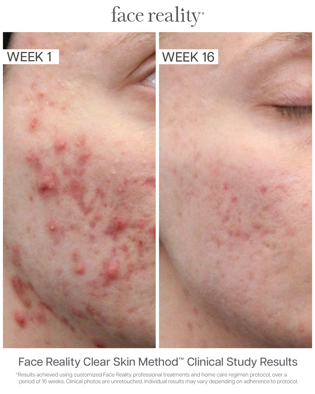 Barrier Balance Creamy Cleanser