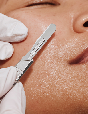 Heyday Dermaplaning Facial Enhancement