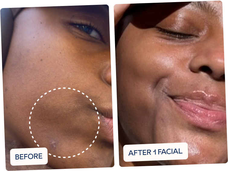 after one facial skin looks and feels less dehydrated