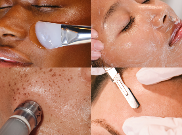 Professional chemical peels, hydro wand infusion, dermaplaning and more are available at Heyday