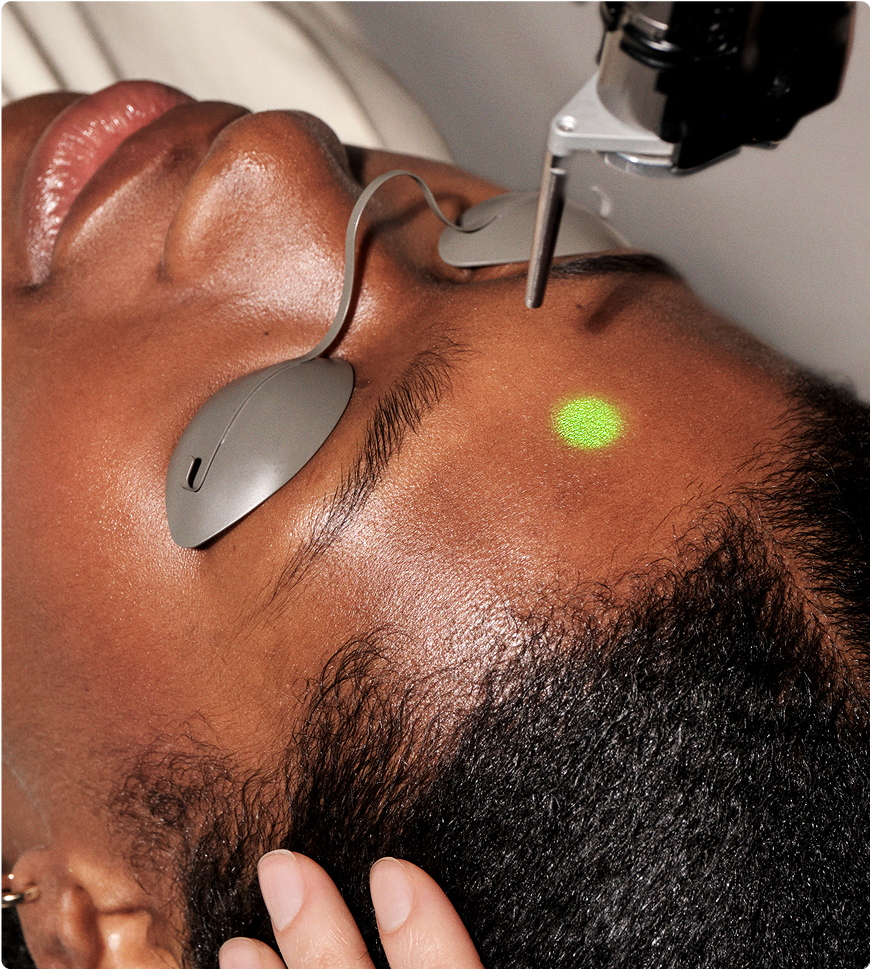 The Heyday Elite Laser Facial