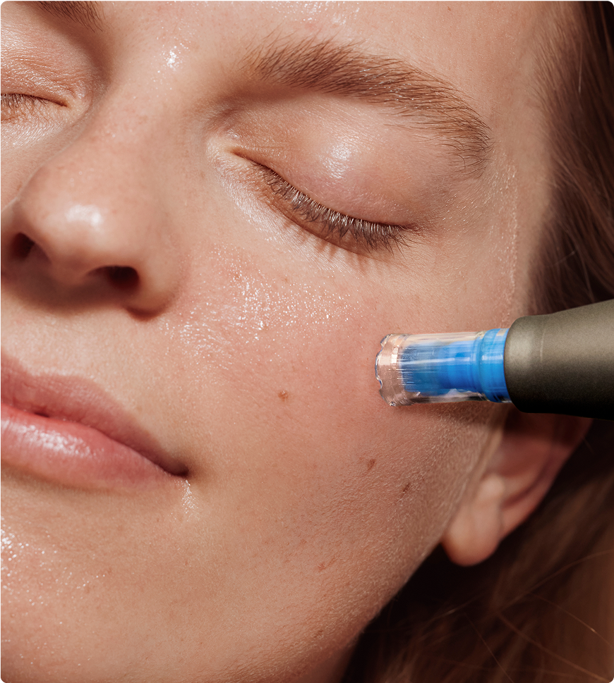 The Heyday Microneedling Facial