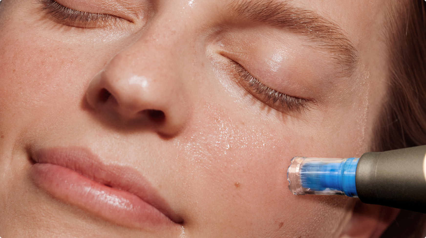 client getting a laser facial at Heyday