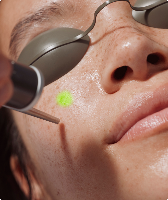 Heyday client getting a laser facial