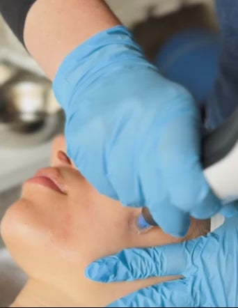 Video showing the process of the microneedling facial at Heyday