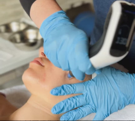 The Heyday Microneedling Facial